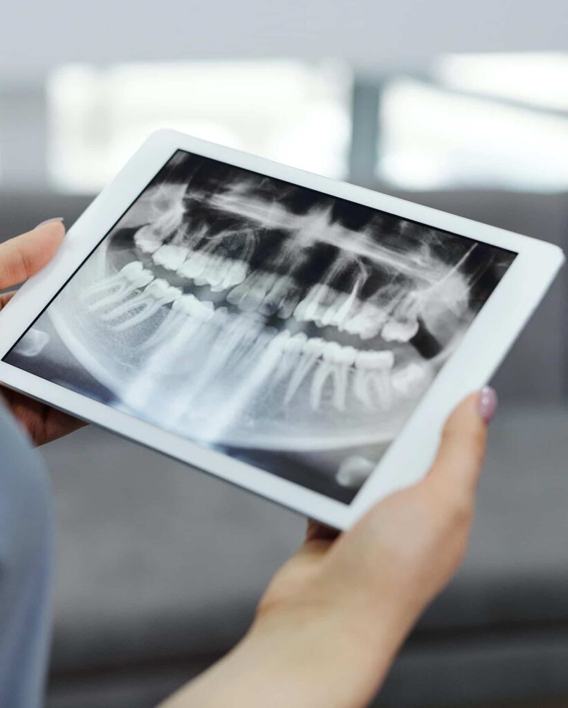 Ein iPad zeigt das Röntgenbild eines Kiefers