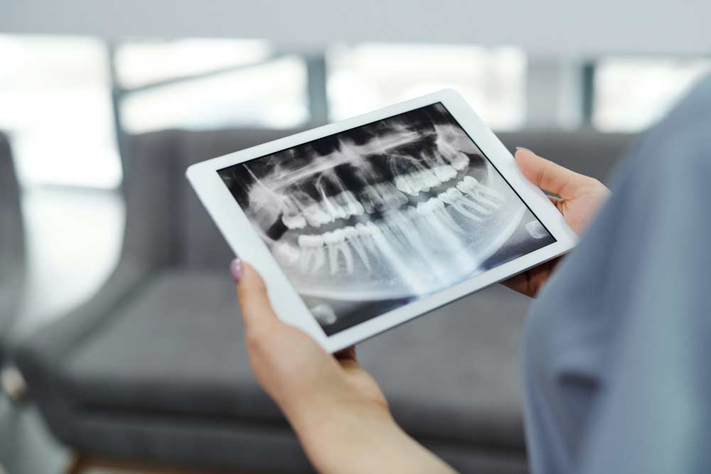 Ein iPad zeigt das Röntgenbild eines Kiefers